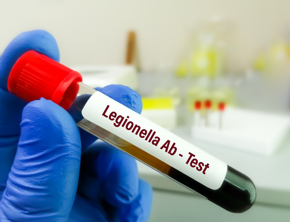 Housing Group Fined £900,000 for Legionella Failures